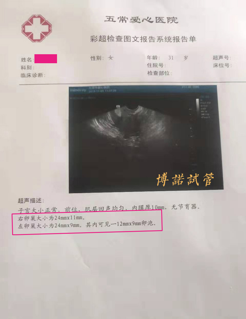 中国代孕流程.jpg