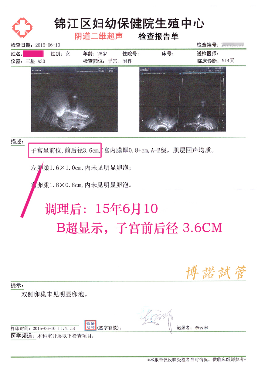 中国代孕妈妈条件.jpg